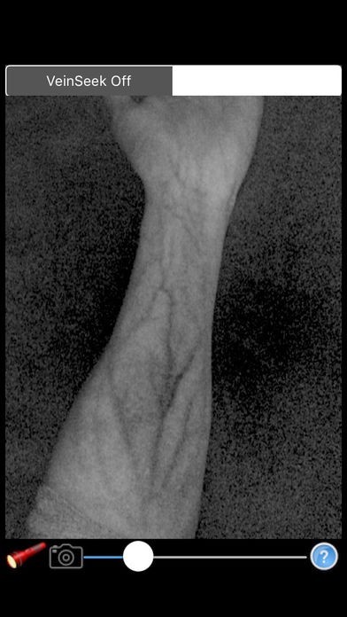 VeinSeek Pro | スクリーンショットその1