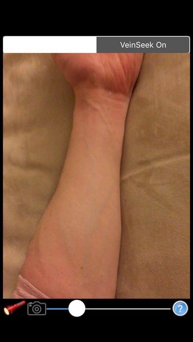 VeinSeek Pro | スクリーンショットその2
