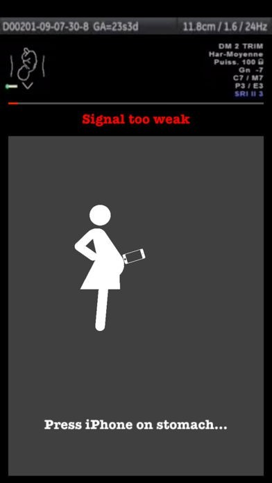 Baby UltraSound | スクリーンショットその1