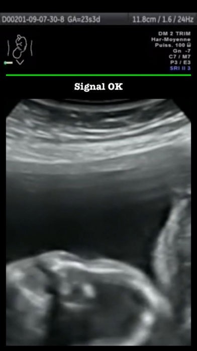 Baby UltraSound | スクリーンショットその2