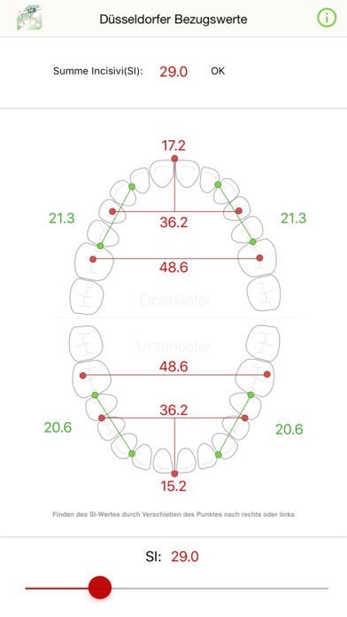 Modellanalyse | スクリーンショットその1