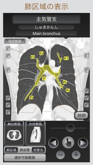裁断済　胸部のCT 4版 胸部CT画像の読影を支援するEIRL Chest CTの販売を開始 - エル