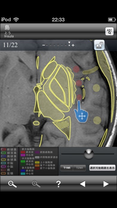 断面図ウォーカー脳MRI | iPhone・Android対応のスマホアプリ探すなら.Apps